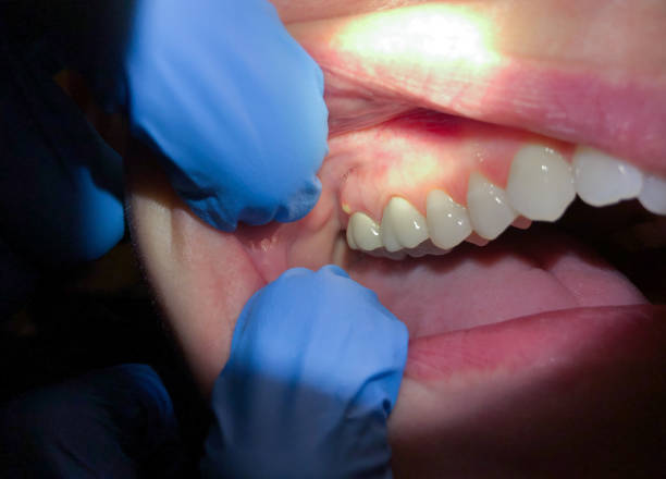Best Emergency Root Canal Therapy in Hinesville, GA