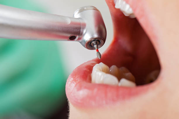 Best Broken or Chipped Tooth Repair in Hinesville, GA